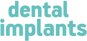 Dental implants - Request an appointment here