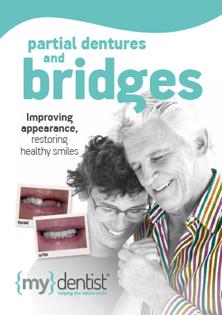 Bridges and dentures