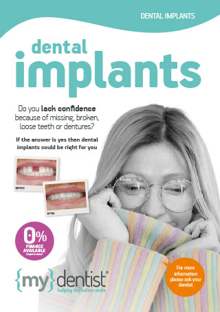 Dental implants